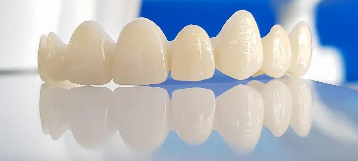 Poza dinti zirconiu - lucrare dentara Poza dinti zirconiu - lucrare dentara