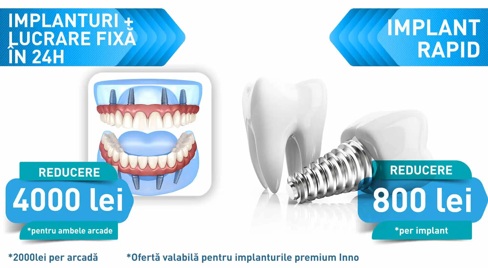 durata implant dentar