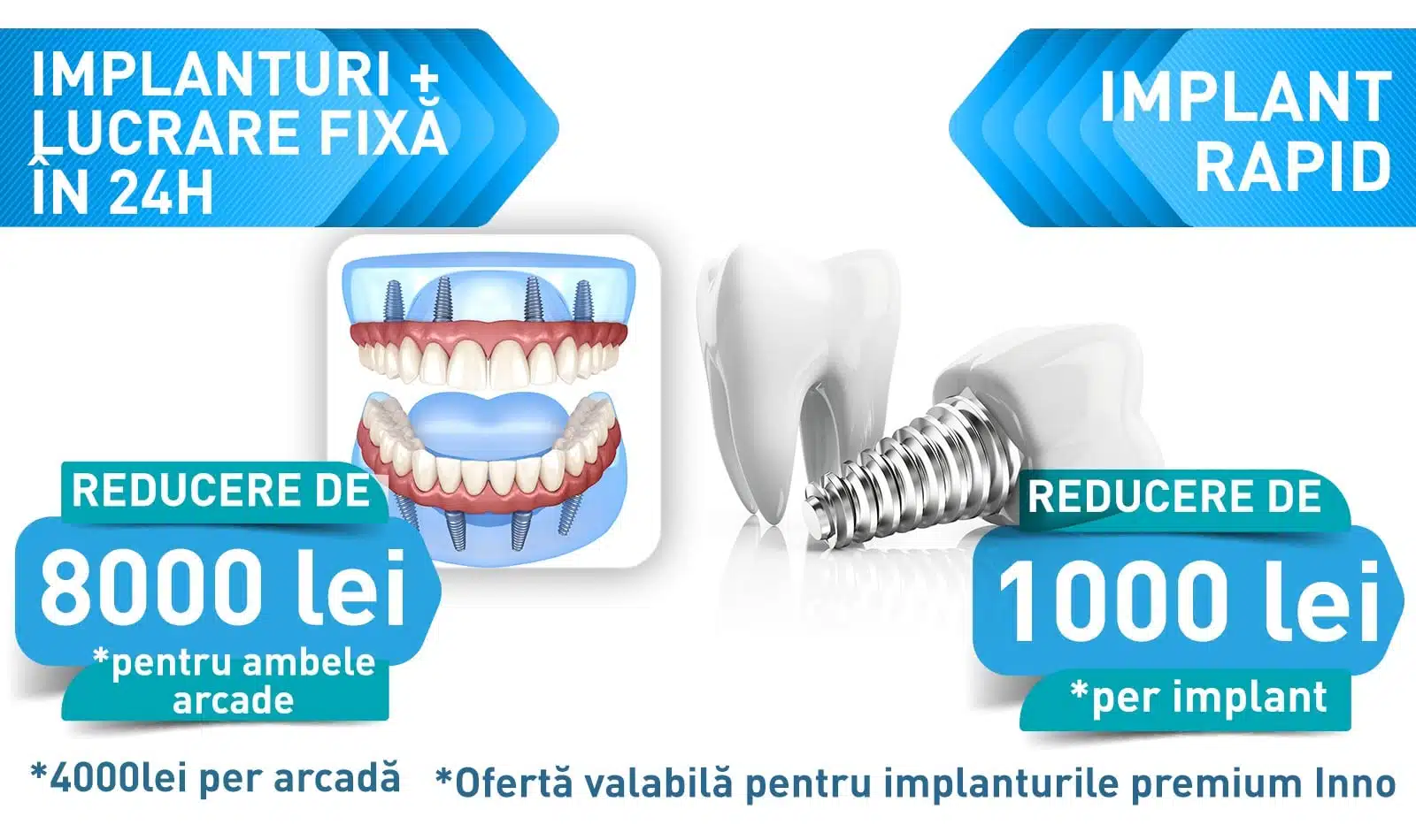 Lucrare fixa pe 4 si 6 implanturi Fast Smile Inno