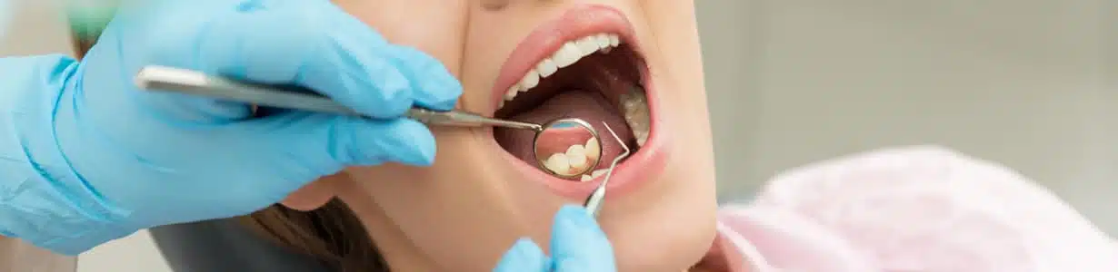 Tratament carii dentare - plomba dentara pentru dinti