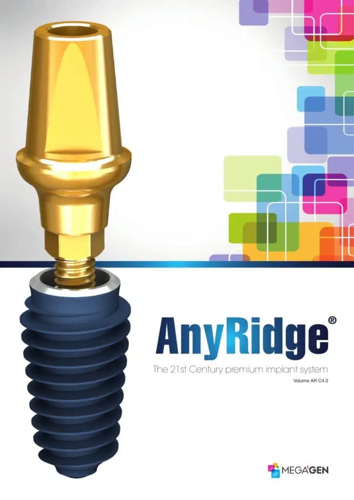 Implant Megagen AnyRidge Implant Megagen AnyRidge