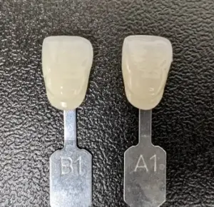 Culoare dinti portelan A1 sau B1