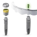 Mini implant dentar Bredent: ce este si preturi