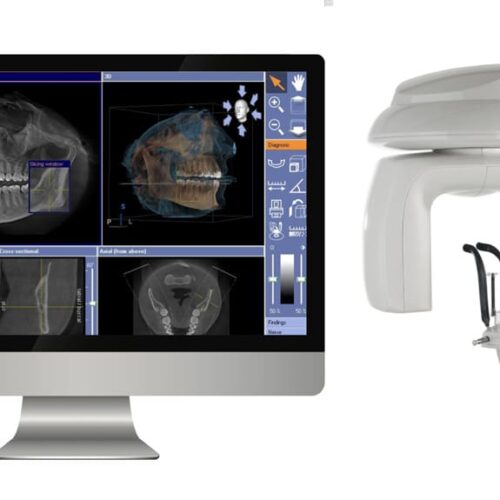 tomografi-dentara-CBCT-pret CBCT - tomografii dentare 3D computerizate