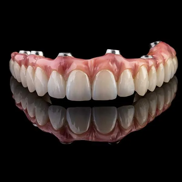 Proteza fixa pe implanturi All-on-6 Straumann Pro Arch