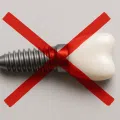 Contraindicatii cand nu se poate face implant dentar