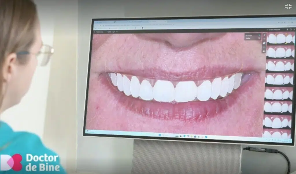 Dinti perfecti cu Digital Smile Design!