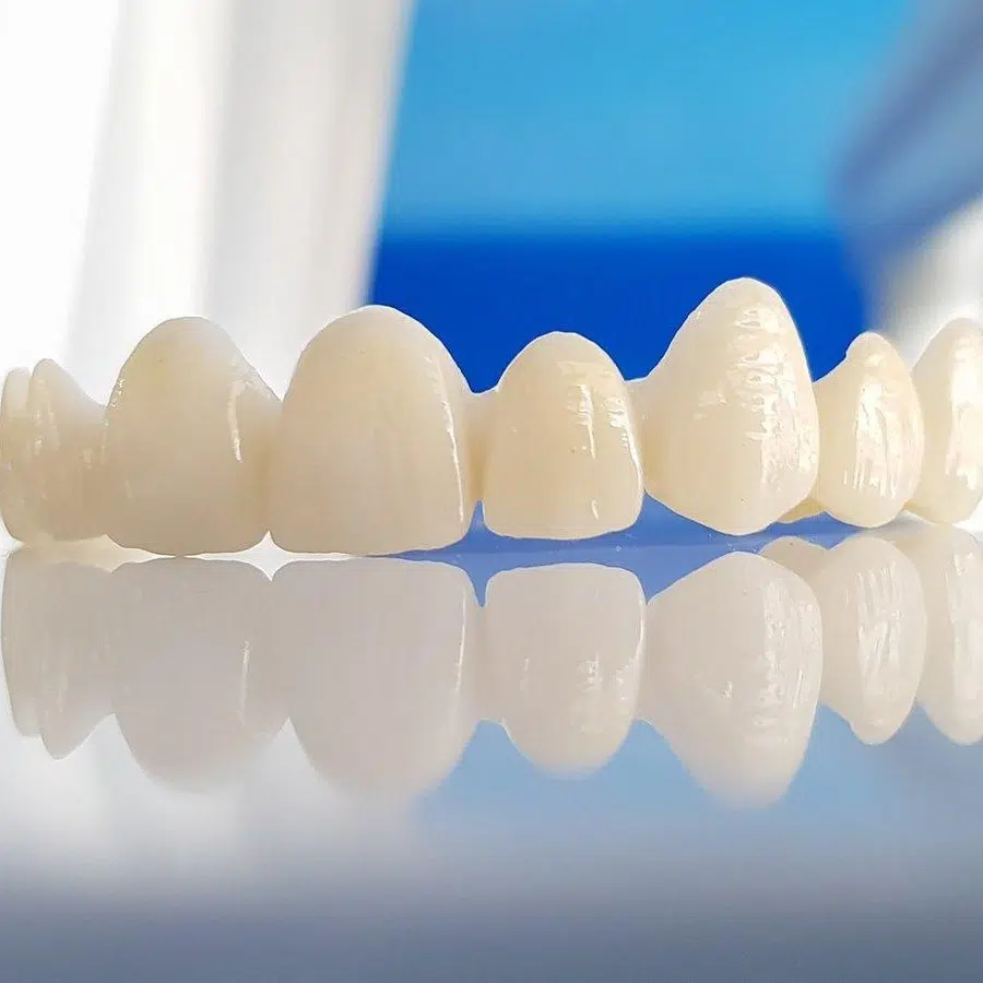 Dintii de zirconiu se ingalbenesc, pateaza sau innegresc
