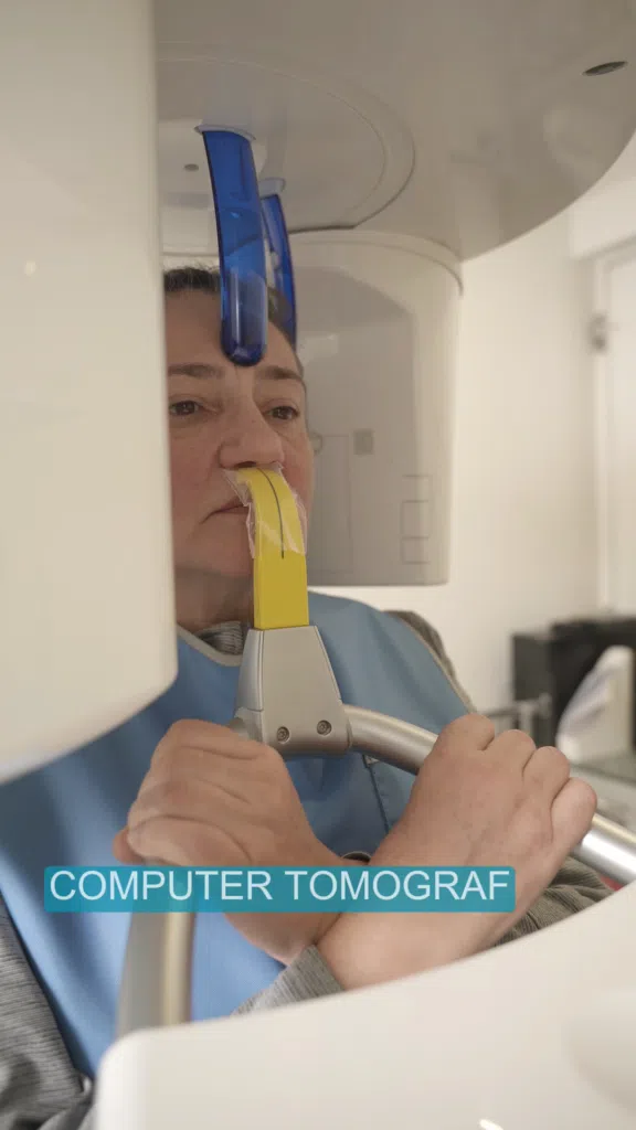 Protocol All-on-X-CBCT Computer tomograf CBCT
