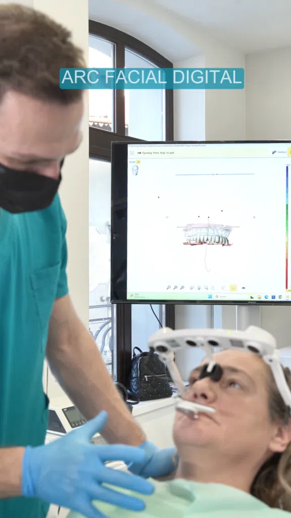 Protocol All-on-X-arc-facial-digital Arc facial digital