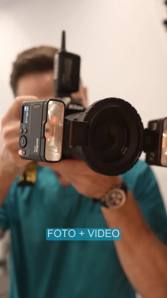 Protocol All-on-X-foto-video Protocol All-on-X fotografii si video cu pacientul inainte de inte