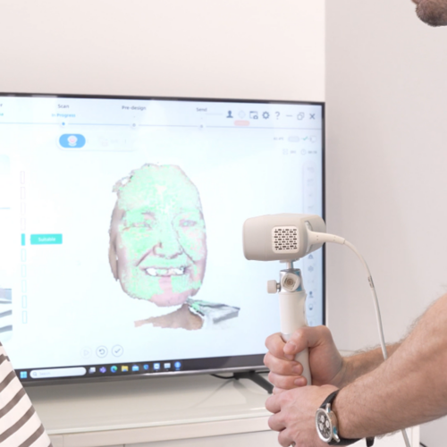 Scanare faciala digitala 3D Scanare faciala digitala 3D