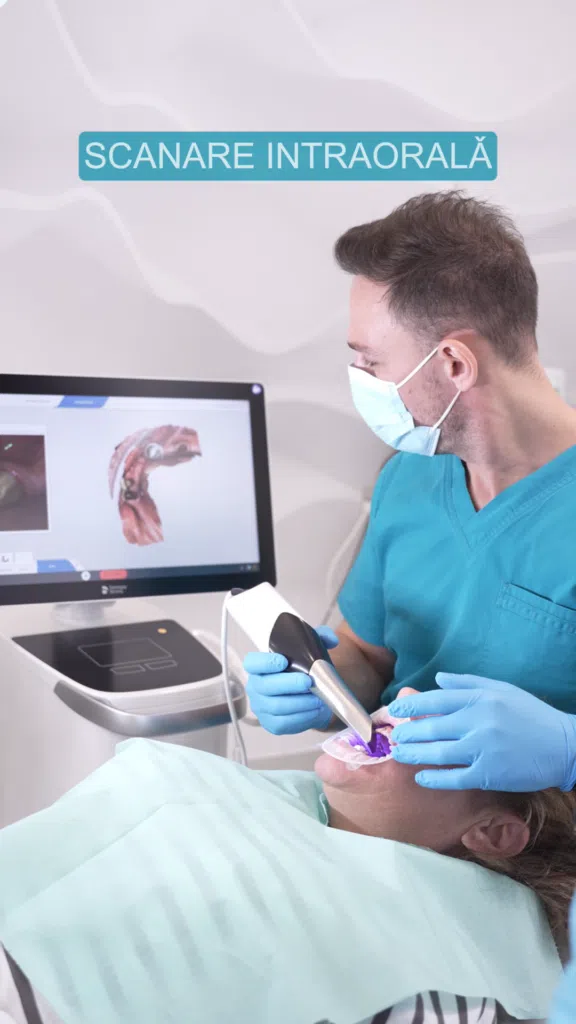 Protocol All-on-X-scanare-intraorala Scanare intraorala digitala
